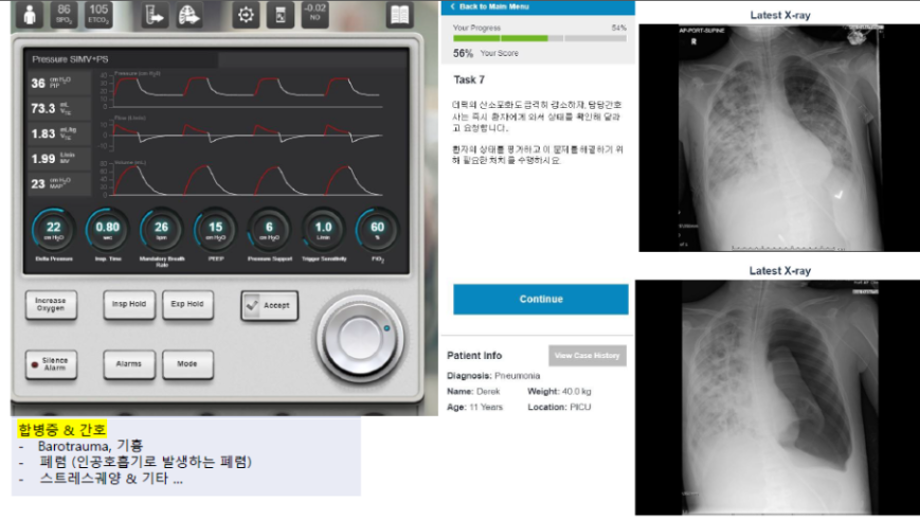 2020 간호사 국가고시 특강 (성인간호학/호흡기계: Ventilator)